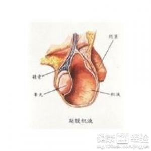 精囊炎的病因有哪些