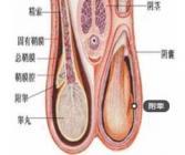 怎么预防附睾炎