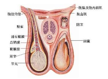 鞘膜积液怎么治疗