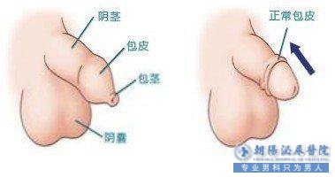 呼和浩特包皮手术价格是多少钱